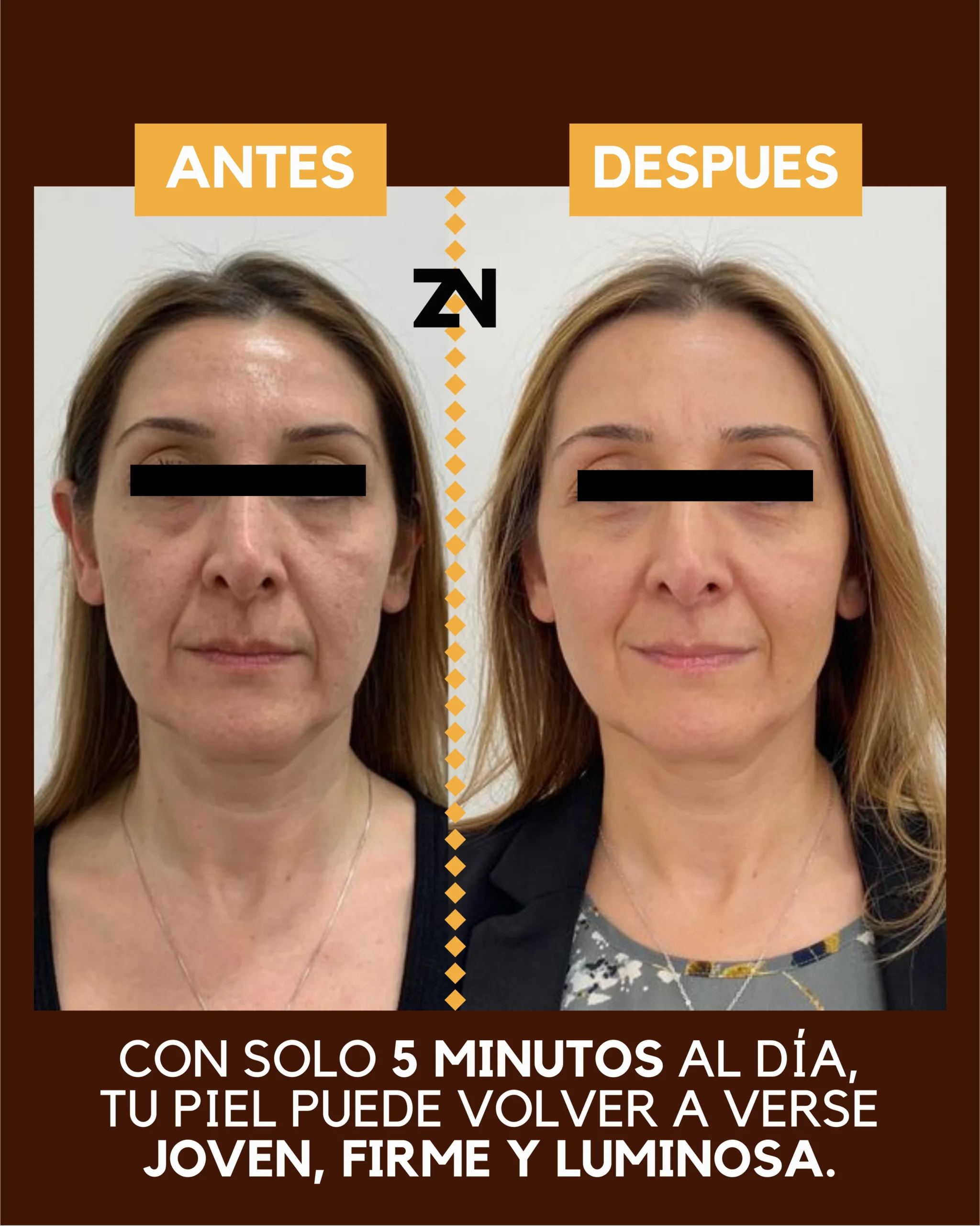 𝐊𝐢𝐭 𝐅𝐚𝐜𝐢𝐚𝐥 𝐑𝐞𝐣𝐮𝐯𝐞𝐧𝐞𝐜𝐞𝐝𝐨𝐫: Serum Facial con Niacinamida y Ácido Hialurónico + Crema Anti-Envejecimiento con Ácido Hialurónico. - Image 5