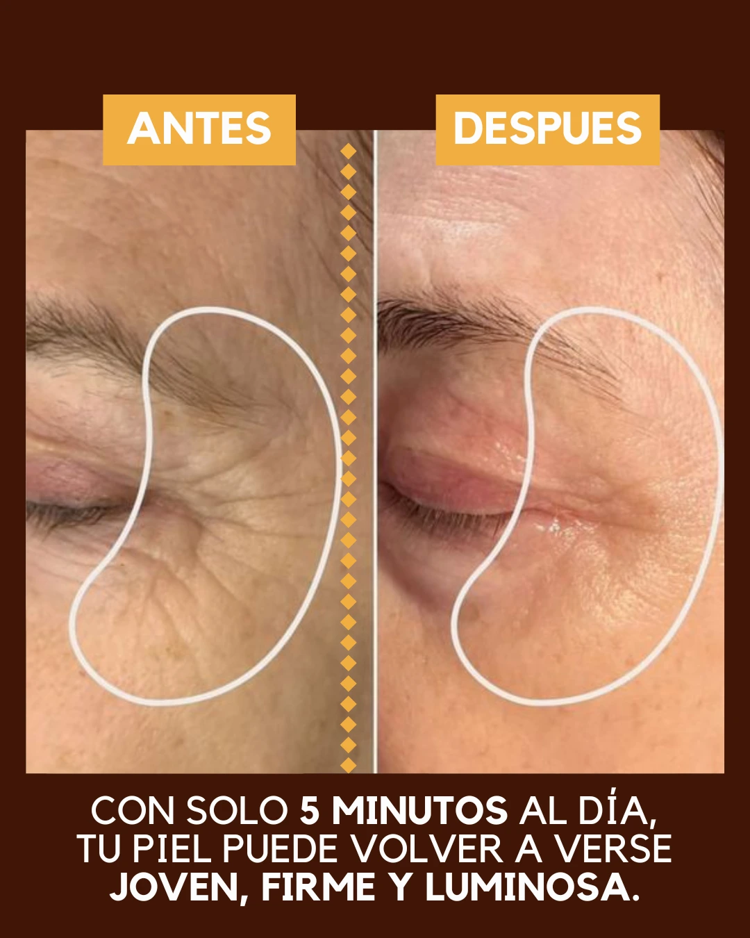 antes y despues del serum con acido hialuronico y niacinamida